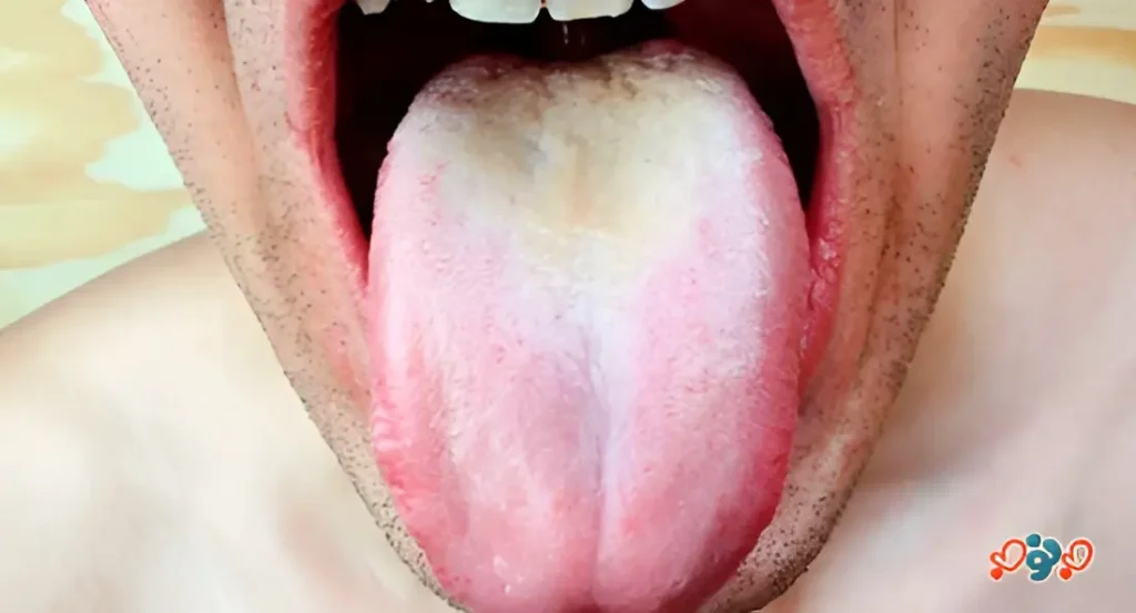 ویروس HIV